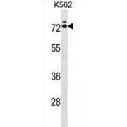 Interleukin 23 Receptor (IL23R) Antibody