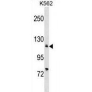 ATPase, Ca++ Transporting, Cardiac Muscle, Slow Twitch 2 (ATP2A2) Antibody