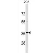 Fast Skeletal Muscle Troponin T (TNNT3) Antibody