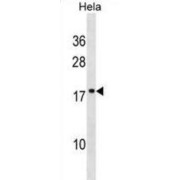 SCAN Domain Containing 1 (SCAND1) Antibody