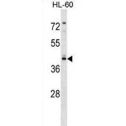 Regulator of G Protein Signaling 11 (RGS11) Antibody