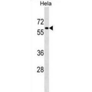 Pancreatic Differentiation Protein 2 (PAF1) Antibody