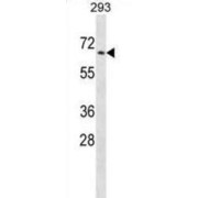 Protein Tyrosine Phosphatase, Non Receptor Type 5 (PTPN5) Antibody