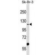 Myotubularin Related Protein 4 (MTMR4) Antibody