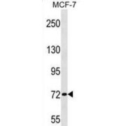 Zinc Finger Protein 408 (ZNF408) Antibody