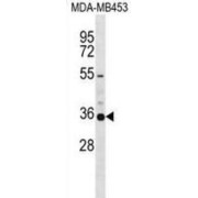 Potassium Voltage-Gated Channel Subfamily A Member 5 (KCNA5) Antibody