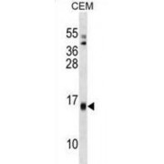 Serum Amyloid A-4 Protein (SAA4) Antibody