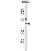 Cytokine Receptor Like Factor 1 (CRLF1) Antibody