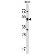 Cartilage Associated Protein (CRTAP) Antibody