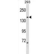 Condensin-2 Complex Subunit G2 (NCAPG2) Antibody