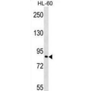 Mitogen-Activated Protein Kinase Kinase Kinase 7-Interacting Protein 3 (MAP3K7IP3) Antibody