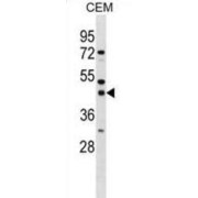 Single-Stranded DNA-Binding Protein 3 (SSBP3) Antibody