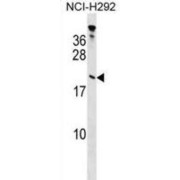 Tubulin Polymerization Promoting Protein (TPPP) Antibody