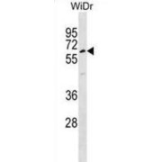 Tubby-Related Protein 1 (TULP1) Antibody