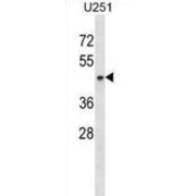 SH3-Domain GRB2-Like 1 (SH3GL1) Antibody