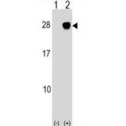 NKG2D Ligand 2 (ULBP2) Antibody