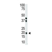 Interleukin-28A (IL28) Antibody