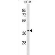 Protein NDRG4 (NDRG4) Antibody