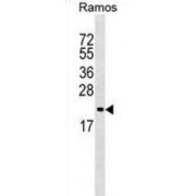 ADP-Ribosylation Factor 5 (ARF5) Antibody