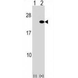 ADP-Ribosylation Factor 5 (ARF5) Antibody