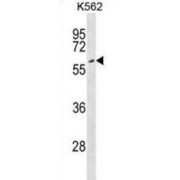 Eyes Absent Homolog 2 (EYA2) Antibody