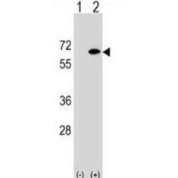 Eyes Absent Homolog 2 (EYA2) Antibody