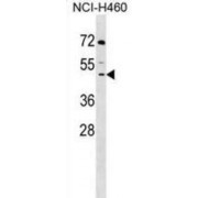 M7GpppX Diphosphatase (DCPS) Antibody