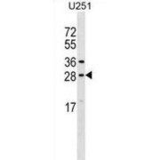 Osteoclast Stimulating Factor 1 (OSTF1) Antibody