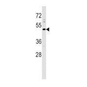 Prolactin-Releasing Peptide Receptor (PRLHR) Antibody