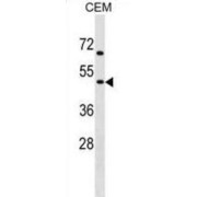 Acetylcholine Receptor Subunit Gamma (CHRNG) Antibody