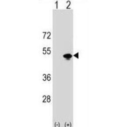 KRR1, Small Subunit Processome Component Homolog (KRR1) Antibody