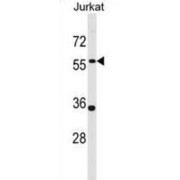 Pannexin-1 (PANX1) Antibody