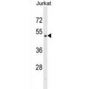 DnaJ (Hsp40) Homolog, Subfamily A, Member 2 (DNAJA2) Antibody