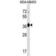 Glucose-Fructose Oxidoreductase Domain Containing 2 (GFOD2) Antibody