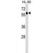 G-Protein Coupled Receptor 97 (GPR97) Antibody