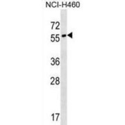 Synaptotagmin 17 (SYT17) Antibody