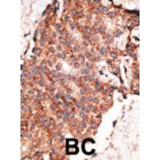 Bone Morphogenetic Protein 1 (Bmp1) Antibody