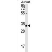 Zinc Finger FYVE Domain-Containing 27 (ZFYVE27) Antibody