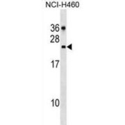 CDC42 Effector Protein 2 (CDC42EP2) Antibody