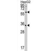 Phosphatidate Cytidylyltransferase 2 (CDS2) Antibody