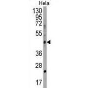 Chitinase Domain-Containing Protein 1 (CHID1) Antibody