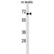 Chromobox Protein Homolog 2 (CBX2) Antibody