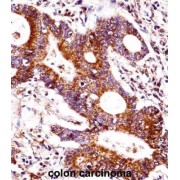 Carcinoembryonic Antigen Related Cell Adhesion Molecule 7 (CEACAM7) Antibody