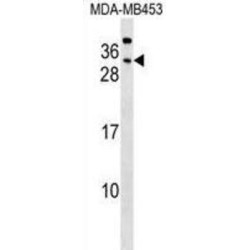 Carcinoembryonic Antigen Related Cell Adhesion Molecule 7 (CEACAM7) Antibody