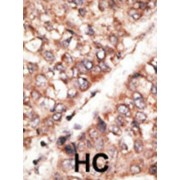 Bone Morphogenetic Protein 3 (Bmp3) Antibody