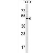 Beta-1,3-Galactosyl-O-Glycosyl-Glycoprotein Beta-1,6-N-Acetylglucosaminyltransferase (GCNT1) Antibody