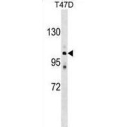 Calcium-Transporting ATPase Type 2C Member 1 (ATP2C1) Antibody