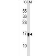 Galectin-Related Protein (HSPC159) Antibody