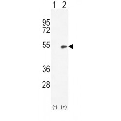 Bone Morphogenetic Protein 4 (BMP4) Antibody