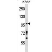 Rab Effector MyRIP (MYRIP) Antibody